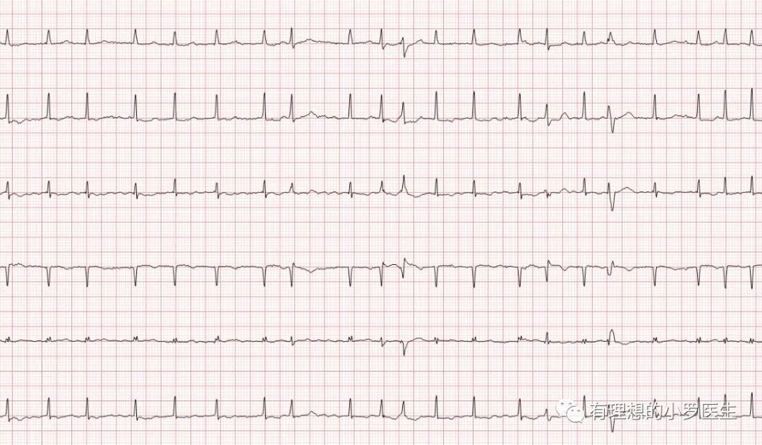 停药的后果,停药后的痛苦事件