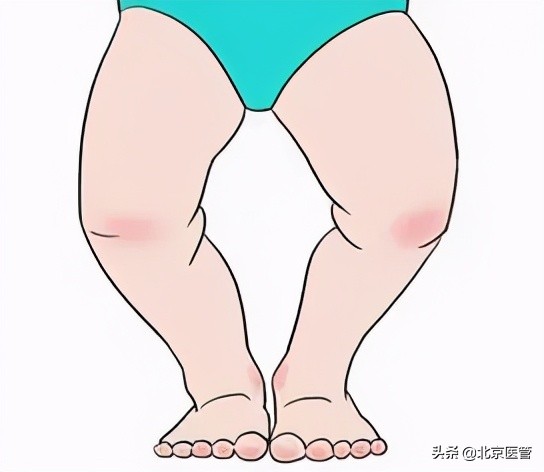 维生素d怎么补孩子长高,宝宝15天后要补维生素d