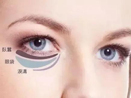 眼袋是怎么造成的怎么可以去眼袋,眼袋是怎么形成的怎么治疗效果好
