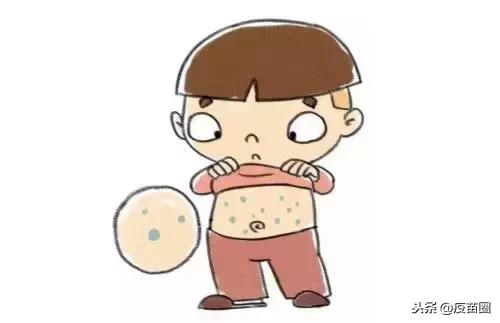 水痘高发期间谨记战痘三大招,水痘高发期战痘防护要做好