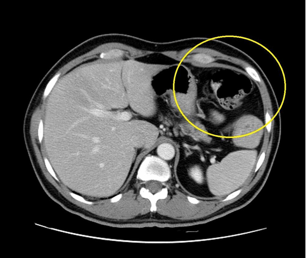 寄生虫操纵人类大脑,操纵意识的寄生虫