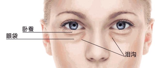 有什么沟必须火的,泪沟后面有一条很深的沟叫什么