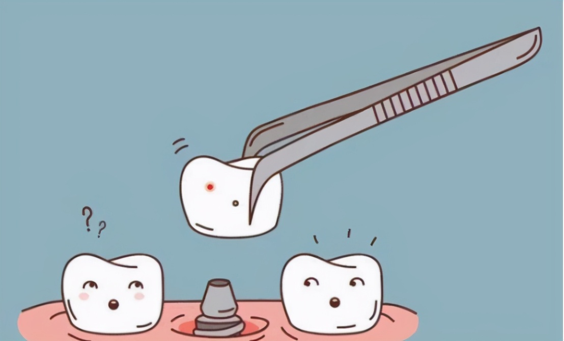 雅悦齿科能恢复牙齿吗,种植牙去医院好还是去康美齿科好