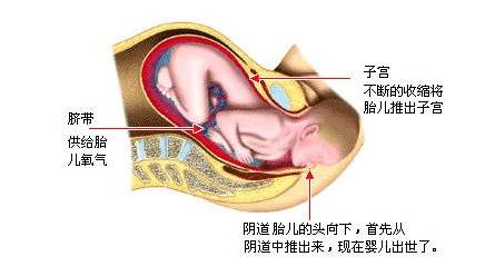 宝宝顺产出生的过程,剖腹产的小孩比顺产的小孩胆小吗