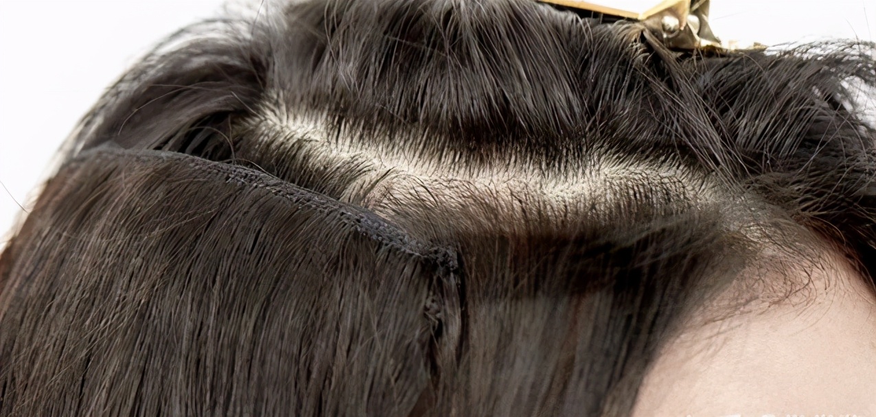 头顶很塌怎么一直蓬松,头顶尖头发塌怎么弄蓬松小妙招