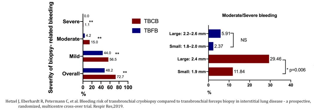 经皮肺穿刺活检术过程,经支气管冷冻肺活检