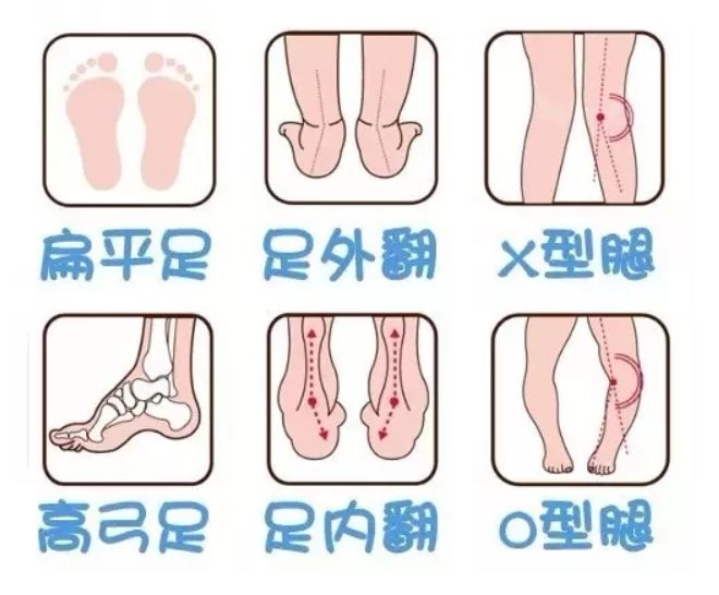 脚踝受伤穿硬底鞋还是软底鞋,小孩穿哪种鞋对脚踝好