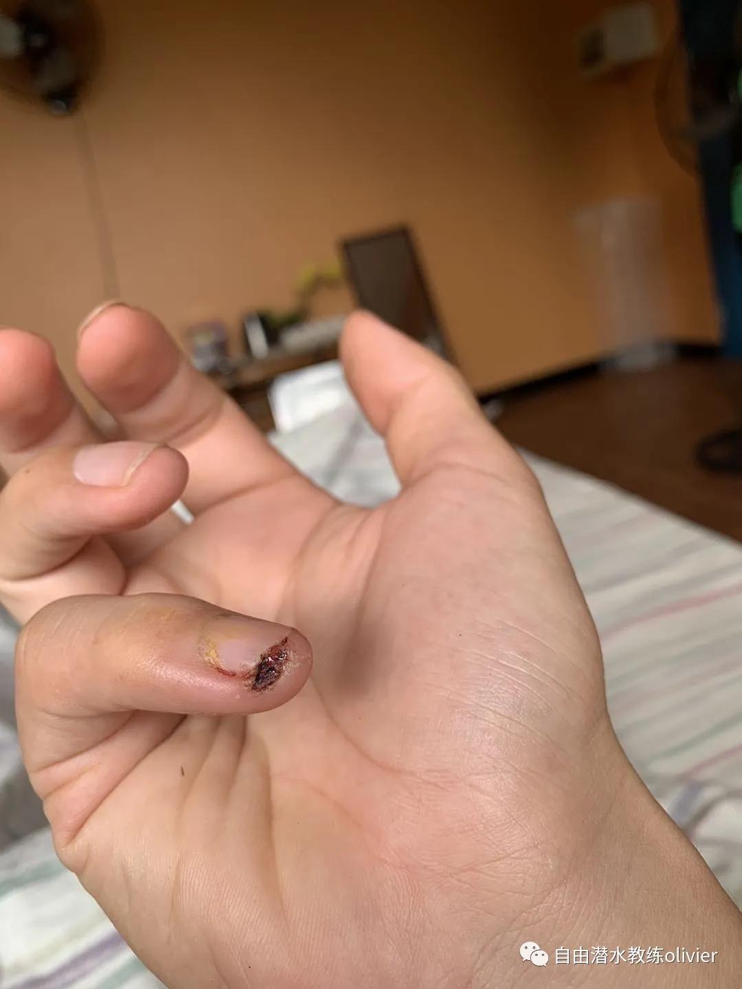 海岛拾荒日记之三十一