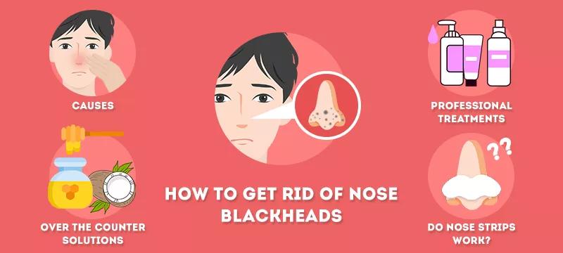 去除黑头最简单最有效的方法,去除黑头既简单又有效的方法