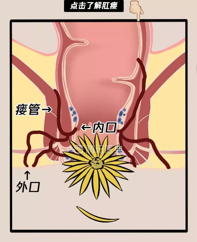 “*菊爆**后”痛到喊妈!真实看病经历泣血奉上,必须保护好菊花