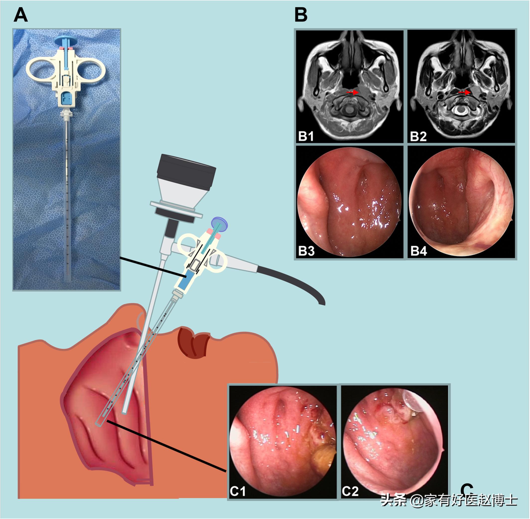 细菌、病毒、寄生虫也可致癌？防癌，务必远离7大常见致癌病原体