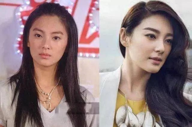 五种双眼皮明星,明星单眼皮张雨绮