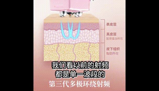 tripollarstop美容仪真假测评,tripollarstopeye测评