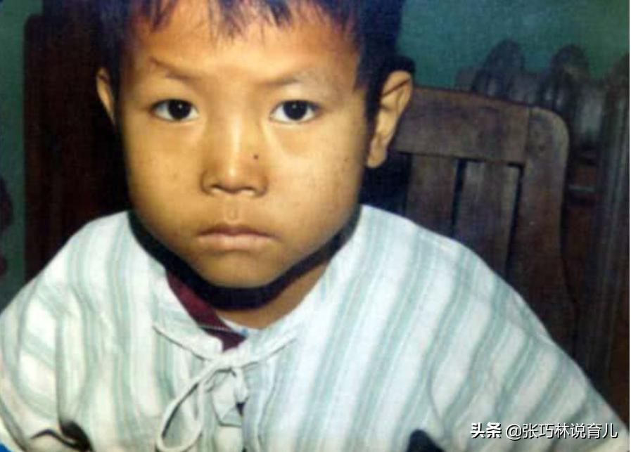 宝宝忽然皮肤黄不一定是黄疸，要警惕：营养和脾胃问题