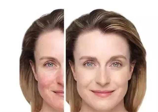 换季过敏起疹子用什么药,脸换季过敏起疹子