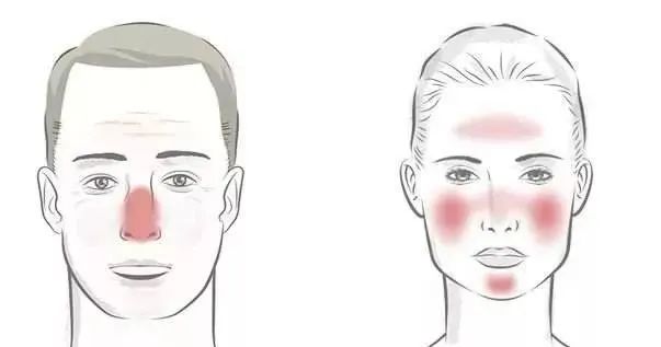 脸发红发烫小妙招有效改善红脸蛋,在暖气屋里脸发红发烫是怎么回事