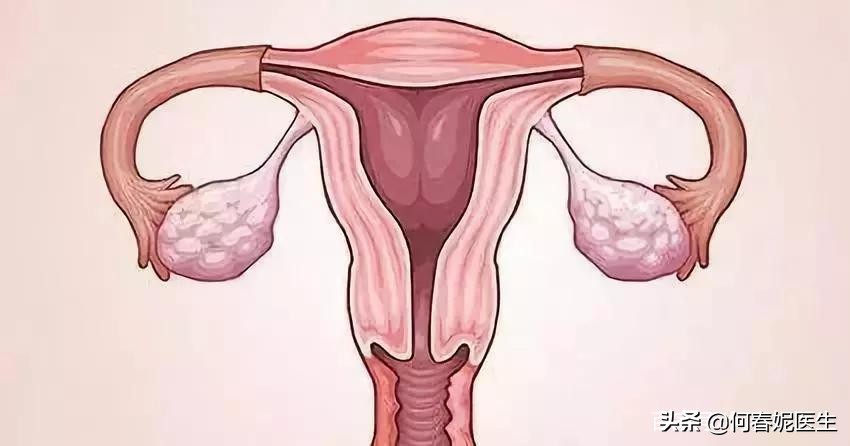 子宫肌瘤手术麻醉方式,子宫肌瘤手术需要住院几天