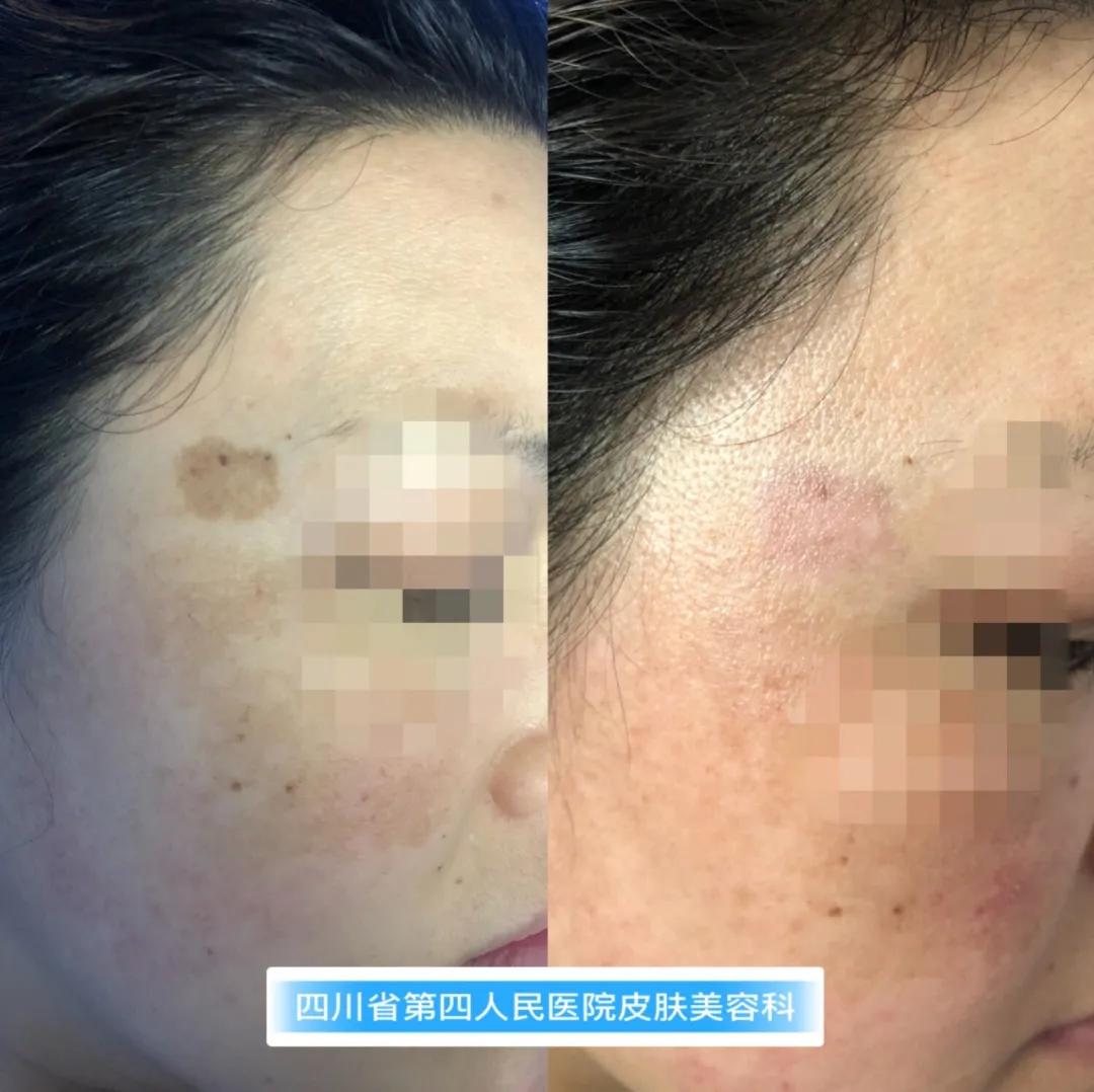 福利来啦促销图片,福利来啦表达什么