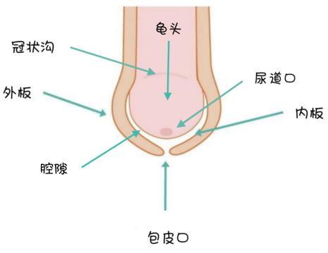 暑期孩子割包皮需要住院吗,暑期到要不要给孩子割包皮呢