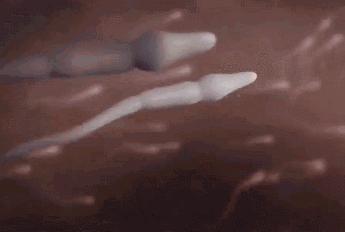 显微镜下x精子与y精子形态差别,精子碎片率跟精子形态成正比吗