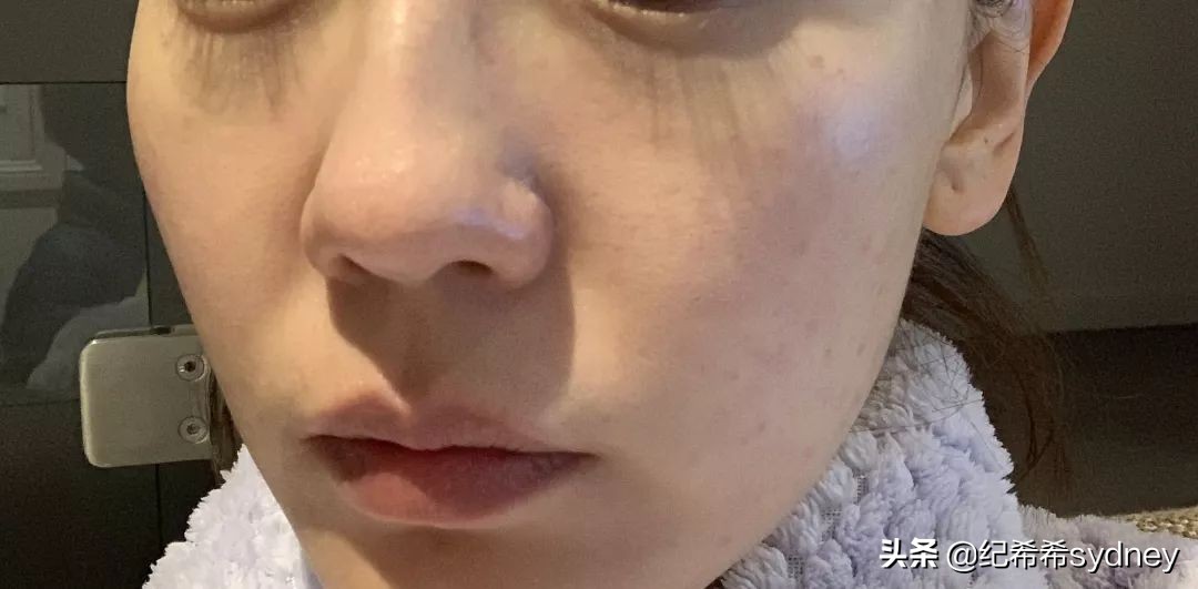 为什么很多人都去做医美了,为什么很多人医美会失败