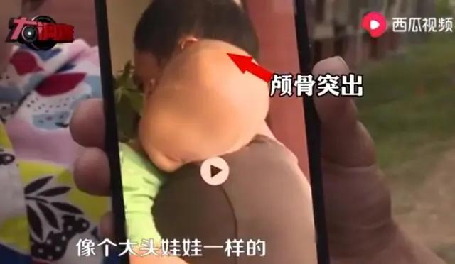 大头娃娃10年后现状,2007年大头娃娃现在怎么样了