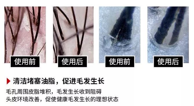 散装洗发液好用吗,洗发液测评红榜前十名