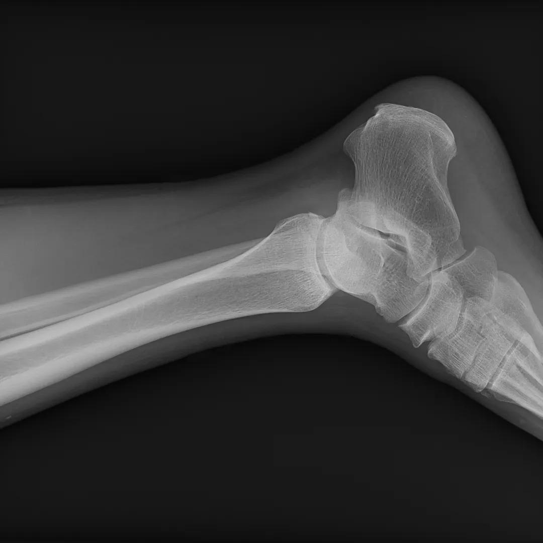 安健科技dr拍片质量怎么样,安健科技DR价格