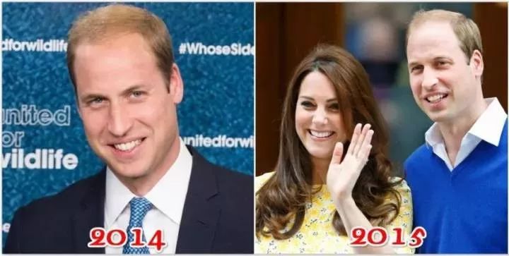 发量减少好不好,发量减小