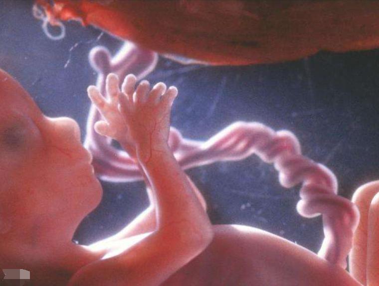 脐带异常为啥引起窒息,脐带过度螺旋呈麻花状