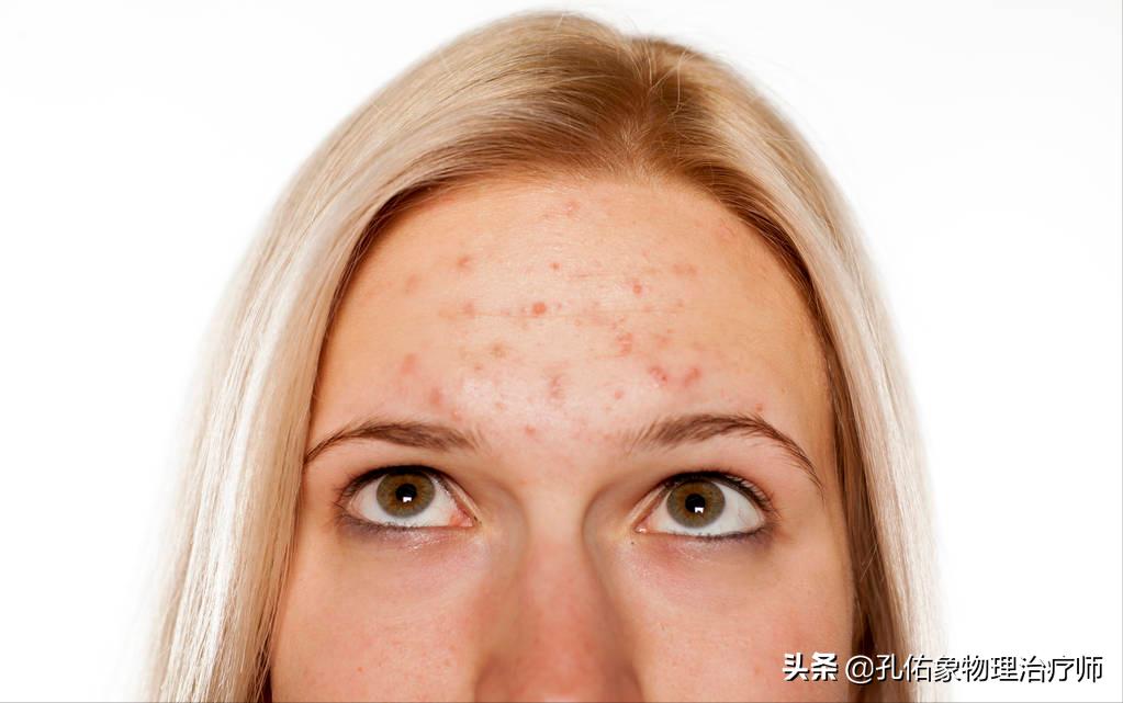 人身上的老年斑怎么去除,年轻人长老年斑消除最好的方法