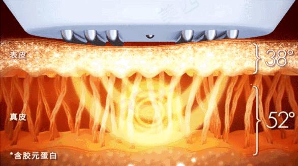 十年光学美容仪,初学者应该怎么选择美容仪