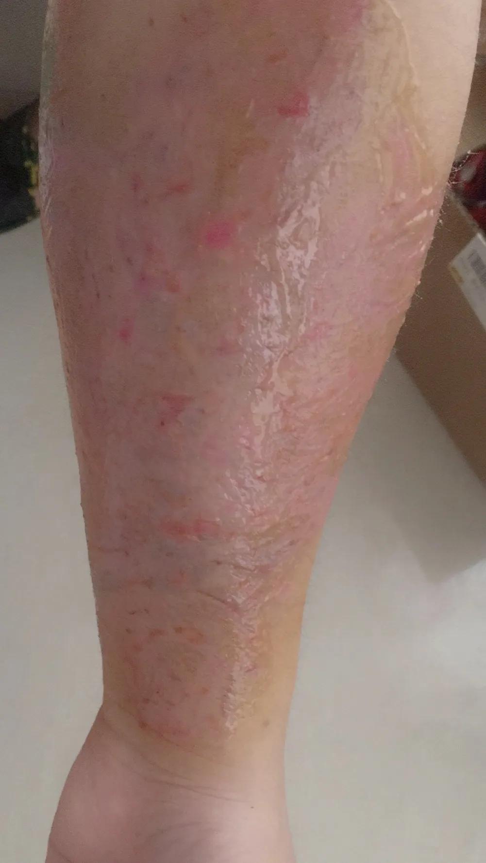 洗纹身能彻底洗掉吗豆瓣,纹身能彻底洗干净吗