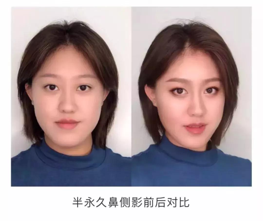 最好看的鼻子分哪几种,最好看的几种鼻子