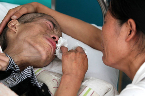 癌症晚期没钱治疗怎么办?看看肿瘤医生给的建议