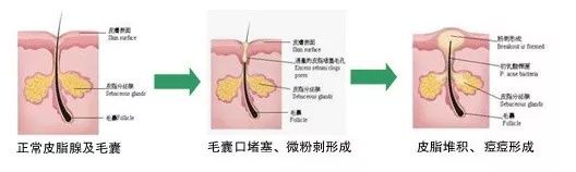 博乐达真的好用吗,博乐达使用前后对比