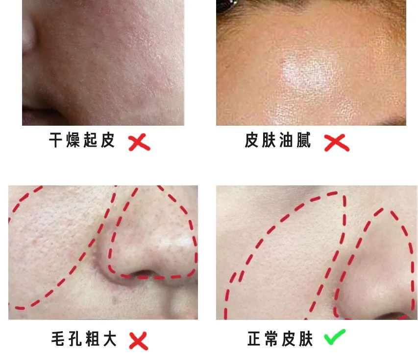 清爽男生穿搭推荐,男生夏天穿什么颜色短袖好看