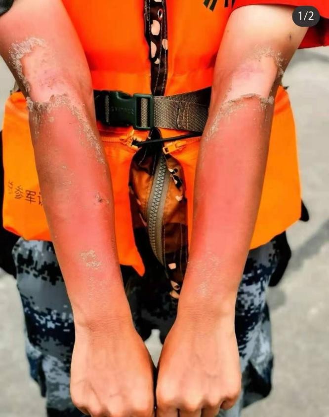 炎炎夏日谨防三类常见病,炎炎夏日谨防空调病