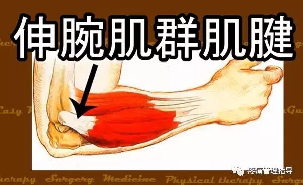 网球肘能自我恢复吗,网球肘病因的解剖学研究