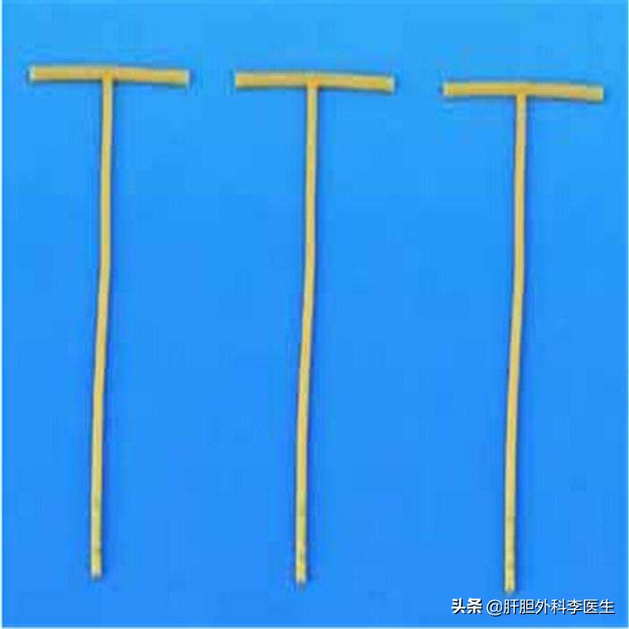 胆囊结石92老人建议做手术吗,九十多岁的老人胆管结石怎么办