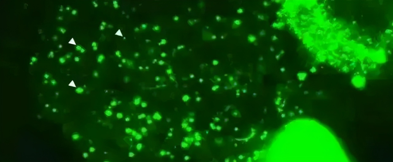 会拉丝的植物面膜,会拉丝的面膜霜