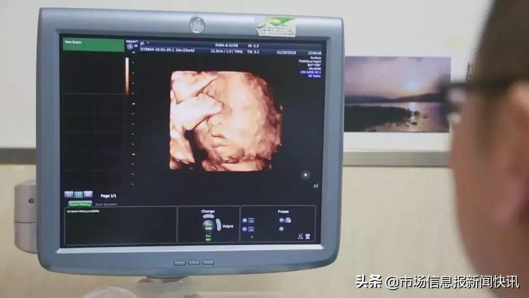 中国首个人工授精出生的女婴,中国首例子宫移植生孩子