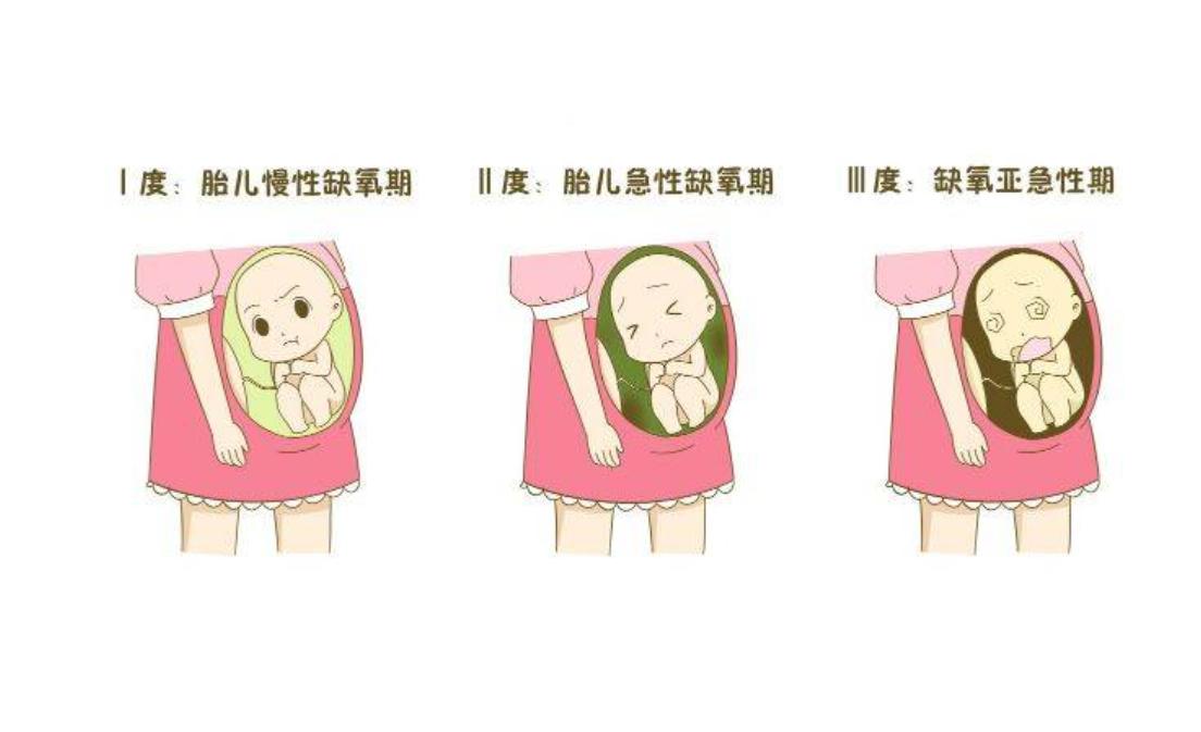 孕妇羊水浑浊对孩子有什么影响,孕期羊水不好怎么办
