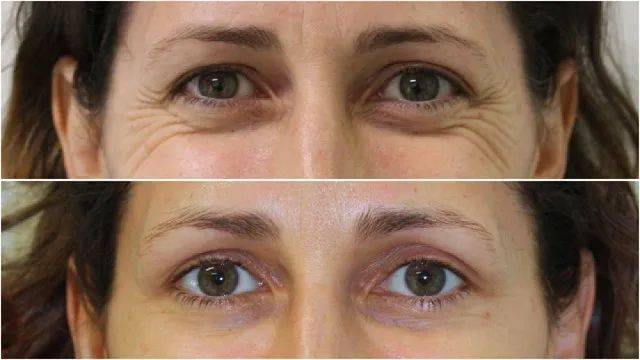 她爆红了整个娱乐圈,她的成名史