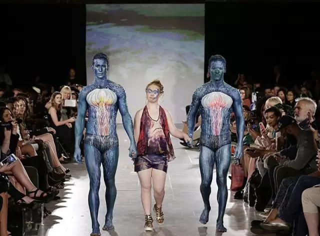 唐氏综合征中国美女,患有唐氏综合征的维密模特