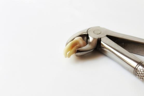 挨着神经的智齿拔一颗大概多少钱,智齿挨着神经能不能拔武大口腔