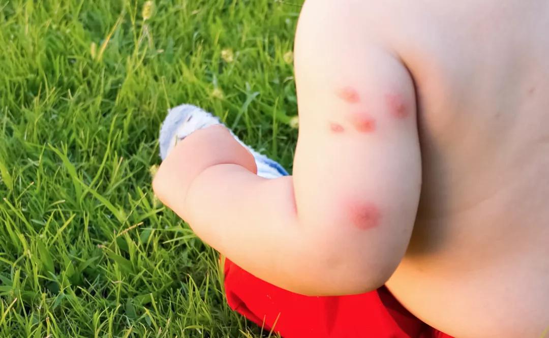 夏天来了用蚊香液更放心,夏天开空调可以用电蚊香液吗