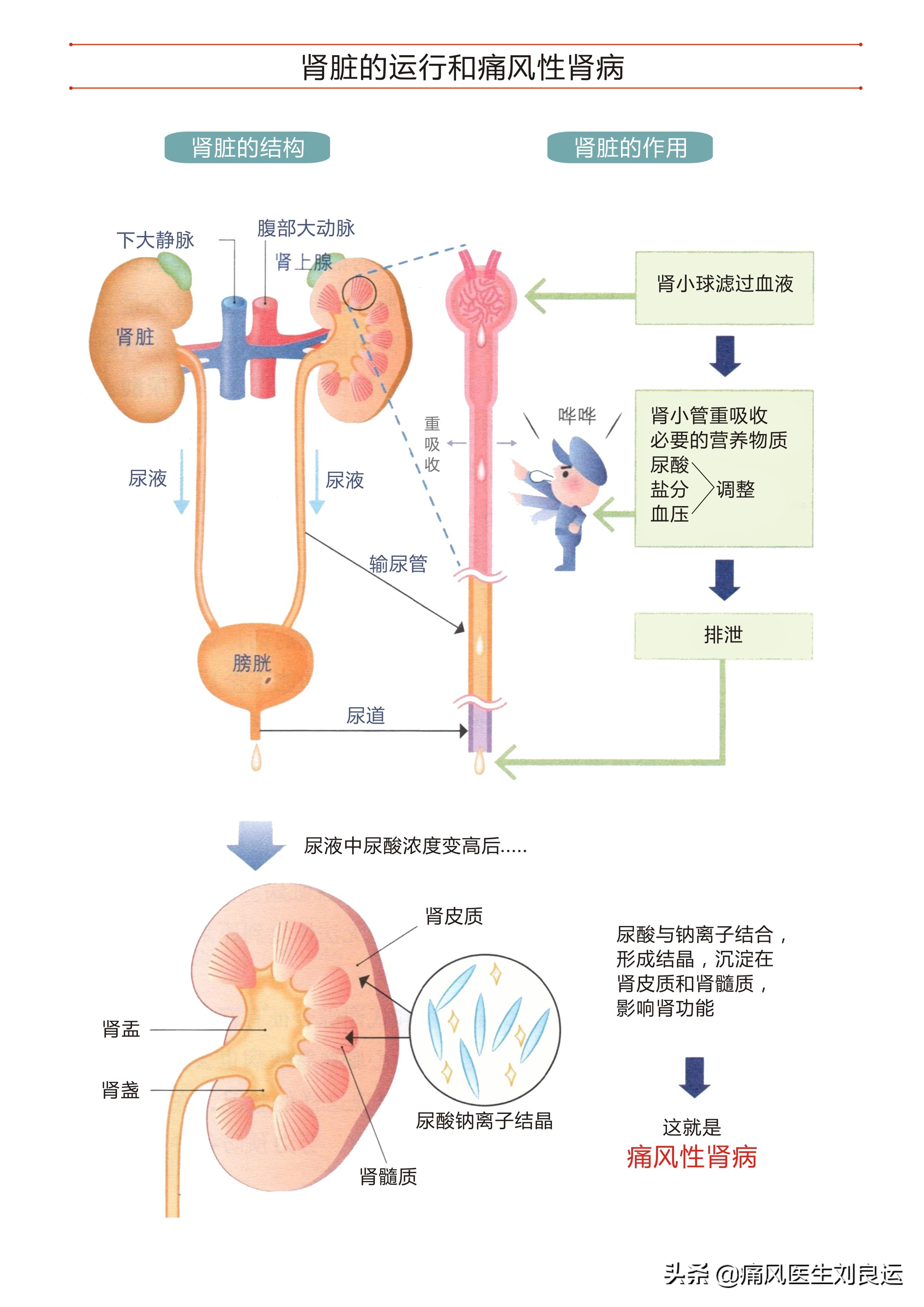痛风能否真正根治,痛风病可以彻底治疗好吗