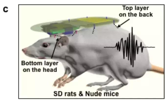 生发帽治疗效果,生发神药发明