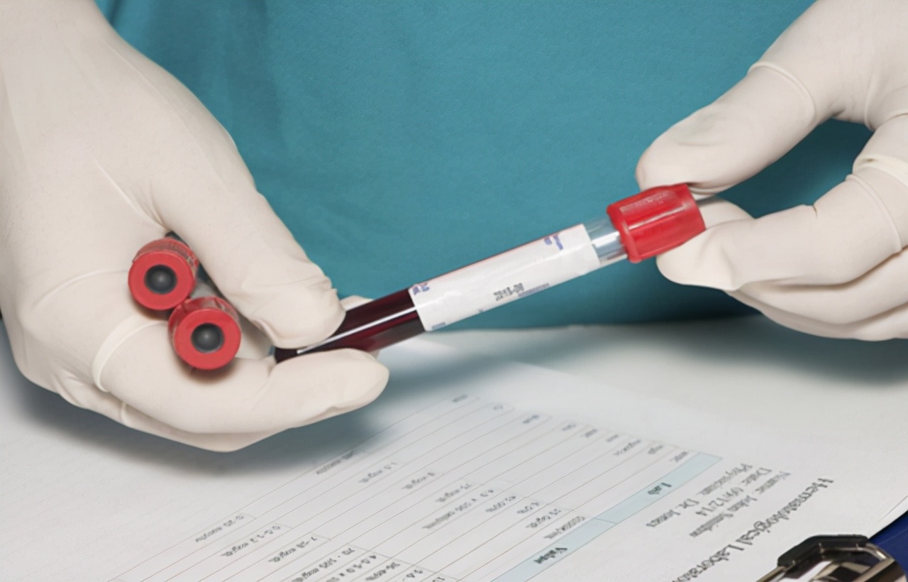 a型b型o型ab型哪种血型的人更长寿,a型b型o型ab型哪种血型更健康